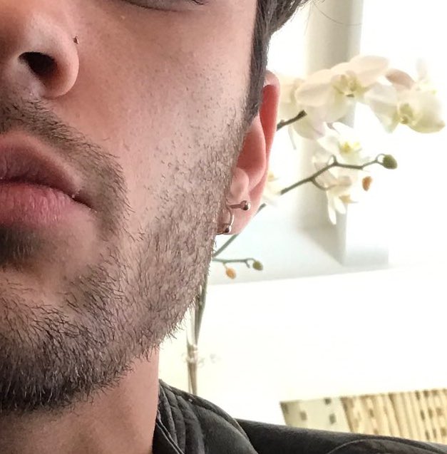 aesthetic:
hair, veins, lips and piercings