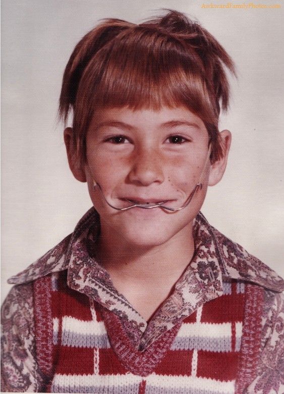 PacOrthodontics's tweet photo. #tbt to the original orthodontic treatment! We specialise in supplying innovative clinic materials to the modern orthodontist #orthodontic https://t.co/N57Ss9wPNb