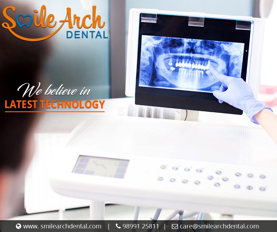 Procedures performed using dental lasers 
may not require sutures.
For more info : smilearchdental.com
#DentistInDelhi #SmileArchDental