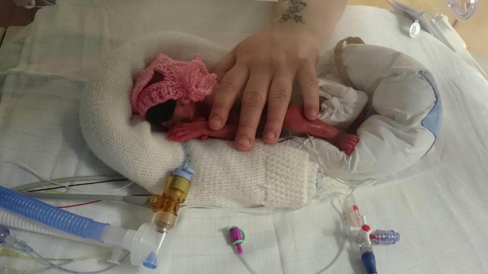 Twitter 上的bbc Breakfast More Premature Babies Than Ever Are Surviving Without Developing Disabilities Earlier We Met Francesca Who Was Born At Just 24 Weeks T Co Lwtxoxetjp Twitter