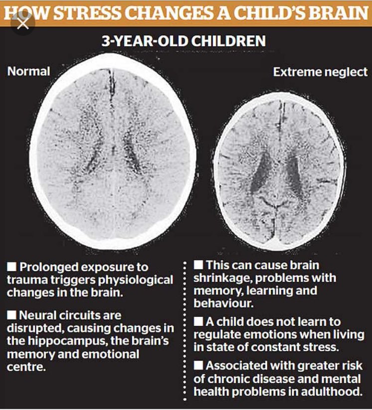 postinstitute01's tweet image. #trauma #adoption #FosterCare #prenatal #family #parenting #love stop #abuse  #neglect #addiction families need support