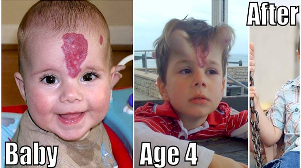 you57949's tweet photo. Boy Got Horn Implants As Birthmark Treatment...Check Out How He Looks After Surgery!  https://t.co/KFUGdzLiNH https://t.co/zt6fMwOoYe