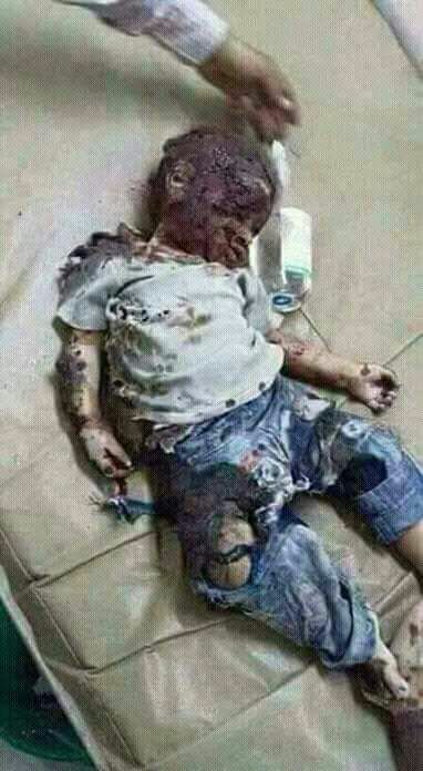 ahrs_mhh's tweet photo. طائرات التحالف تقتل نساء وأطفال اليمن من أجل شرعيه رئيس لم يستطيع دخول عدن المحررة فكيف لنا أن نصدق مسرحيه دخول صنعاء https://t.co/OQCWtXhDG4