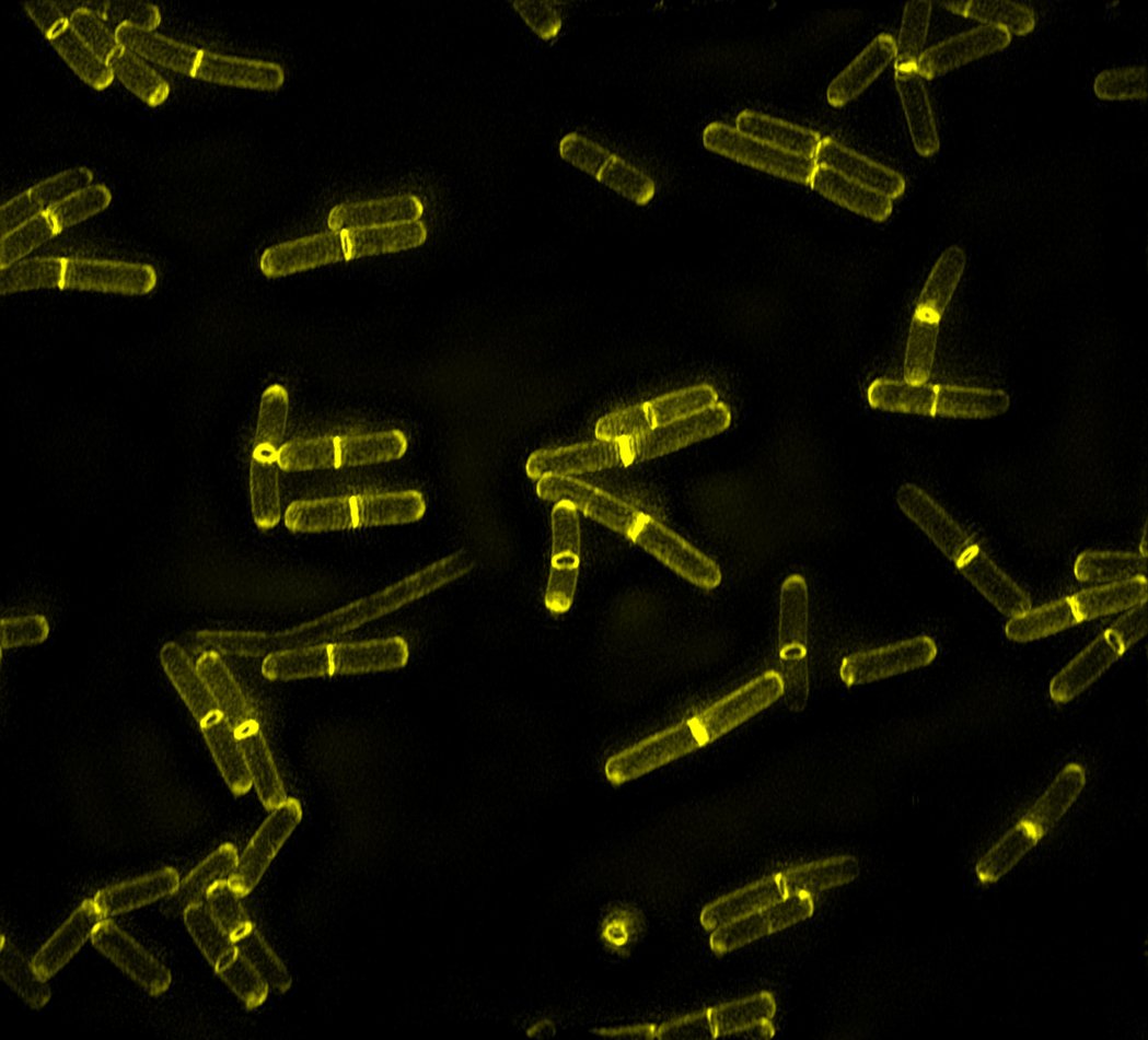 News at IU (@iunewsroom) on Twitter photo .<a href="/IUBloomington/">IU Bloomington</a> researchers help add greater precision to fight against antibiotic-resistant bacteria: go.iu.edu/1tAL .<a href="/IUBloomington/">IU Bloomington</a> researchers help add greater precision to fight against antibiotic-resistant bacteria: go.iu.edu/1tAL