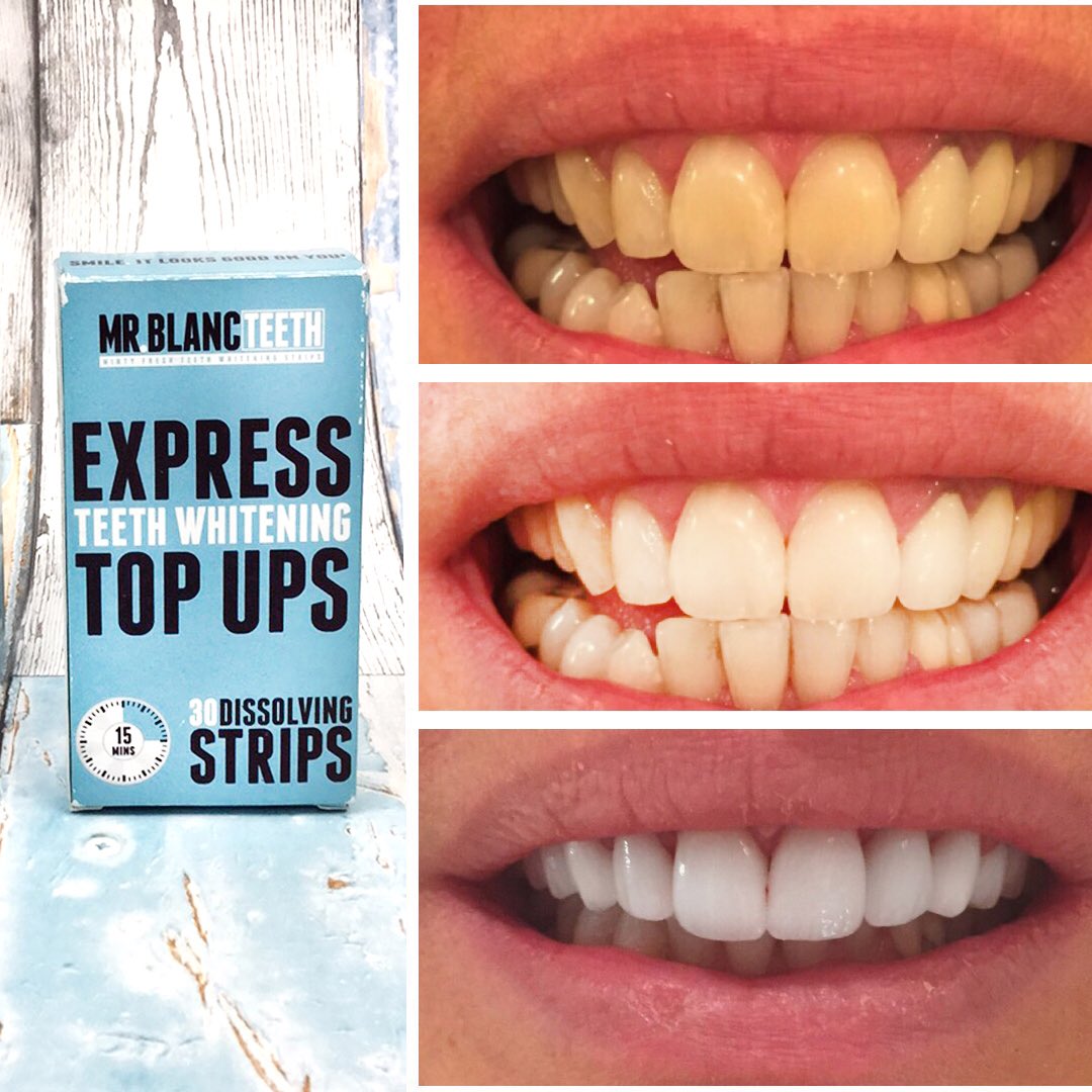 Mr.Blanc on Twitter "30 dissolving strips in each box of MrBlanc