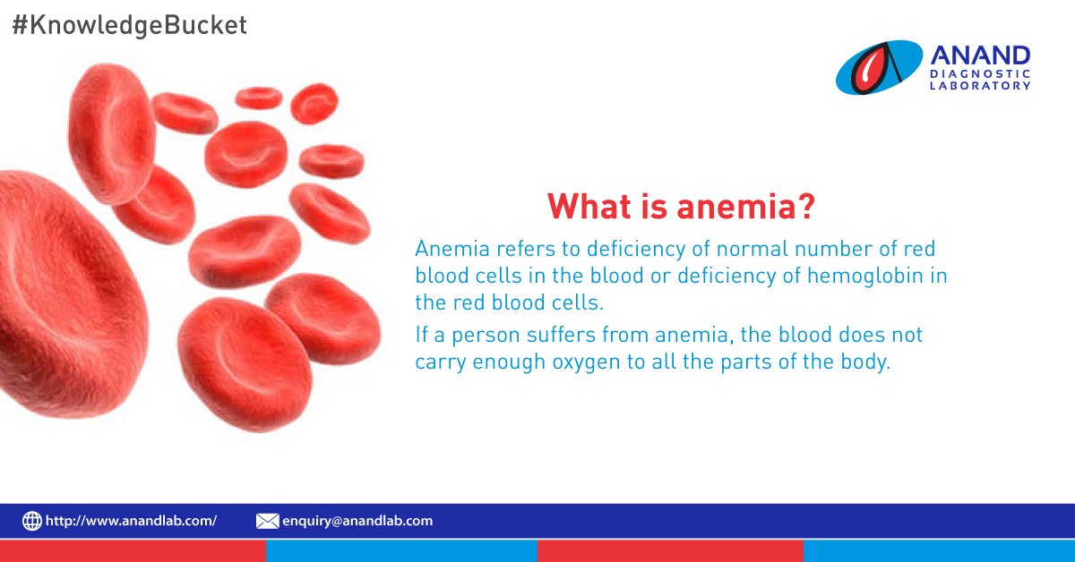 AnandLab's tweet photo. Anemia is the most common health problem in women. #KnowledgeBucket #HealthyShe https://t.co/Vh3ySQrpMD