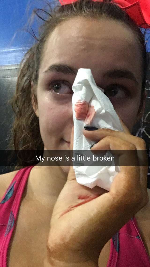104bgantner's tweet photo. I had a rough night https://t.co/m7Ow5U0jrt