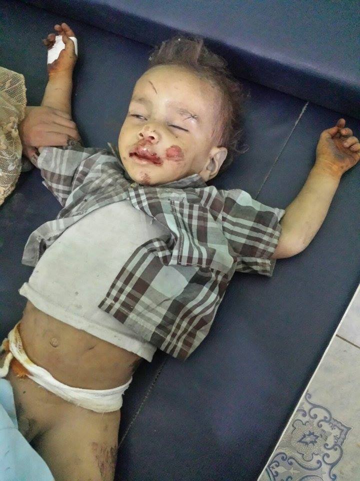 ebrahiim16's tweet photo. #End_Yemen_Siege https://t.co/GMq31DHqCA