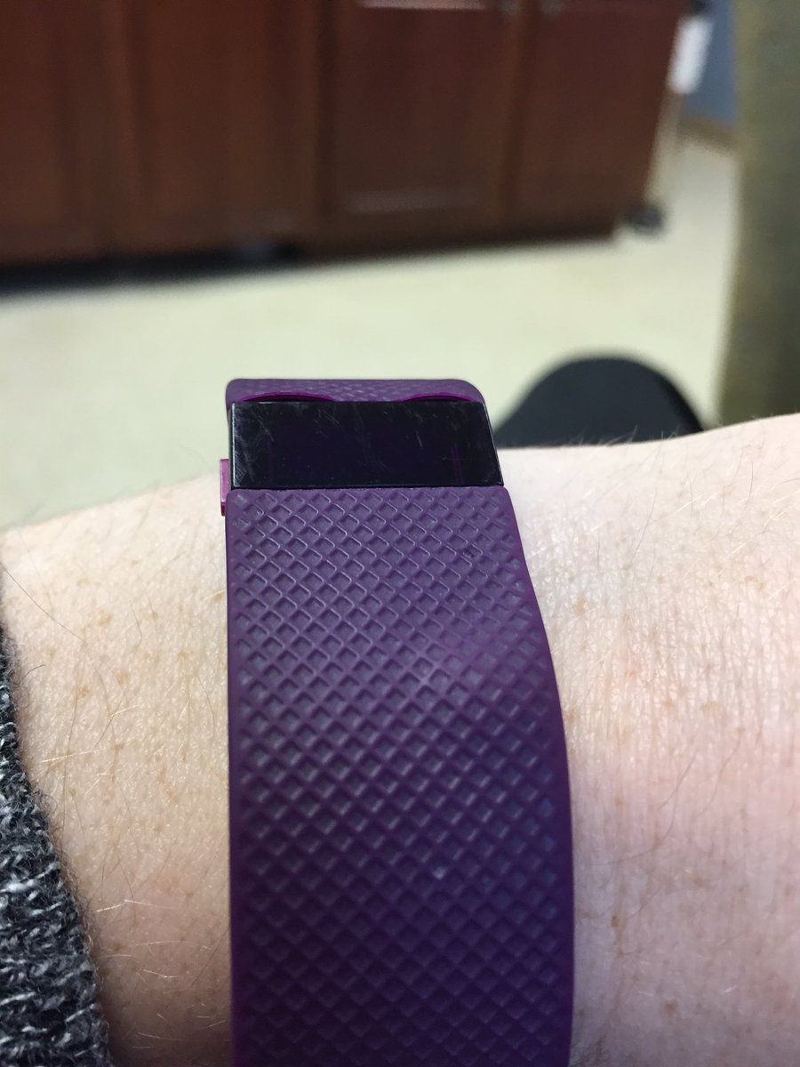 mcavoyal's tweet photo. @FitbitSupport My band has a bubble and seems to be coming apart. Anything you can do to fix/replace? < 1 yr old. https://t.co/OSqIDx1VMj