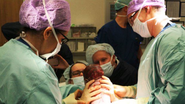 Primeur in Nederland: moeder tilt zelf dochtertje uit haar buik tijdens keizersnede rtlnieuws.nl/gezondheid/pri…