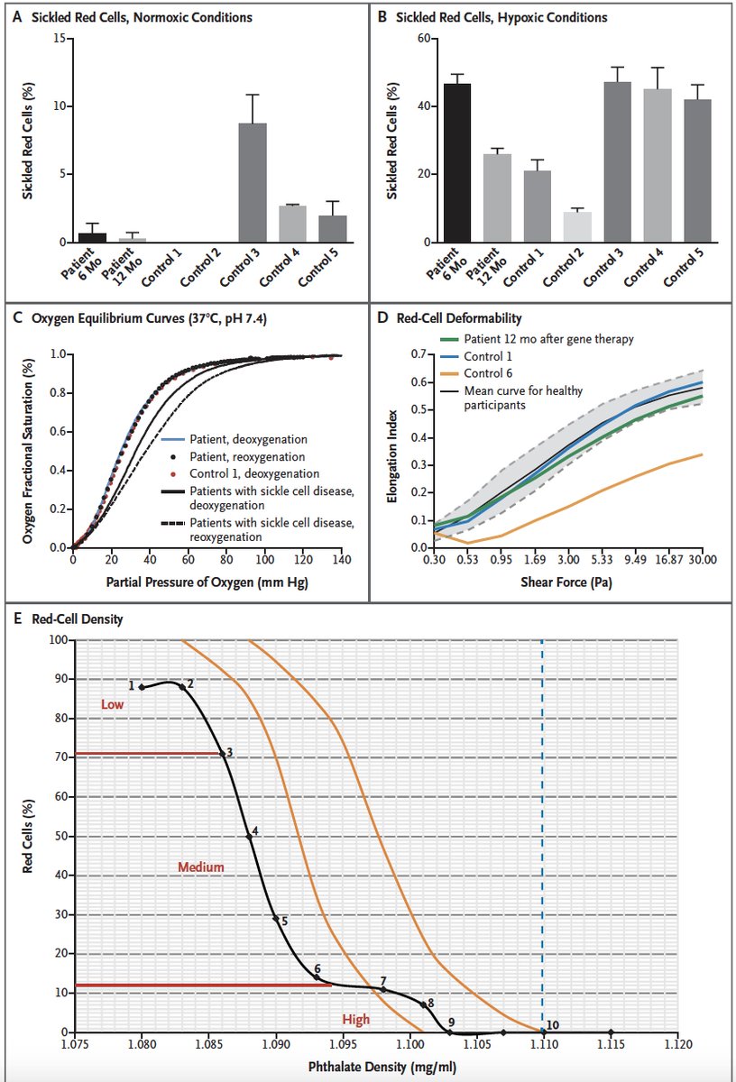 1st-cure-of-a-patient-with-sickle-cell-disease-via-gene-therapy-no