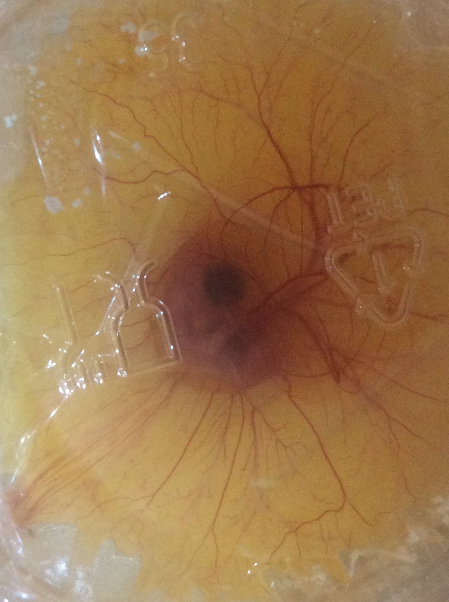 kfalconer109's tweet photo. We can see the amniotic vesicles around the embryo &amp; they're moving. We lost 1 more, but still have 4 viable embryos growing and moving. https://t.co/5E4H3sZzfZ