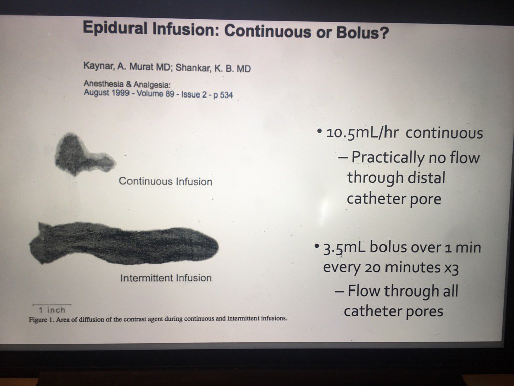 Ritaagarwal6's tweet image. #sppm2017 #pedspain Wre Doing it All Wrong says Dr Record. What do you think?