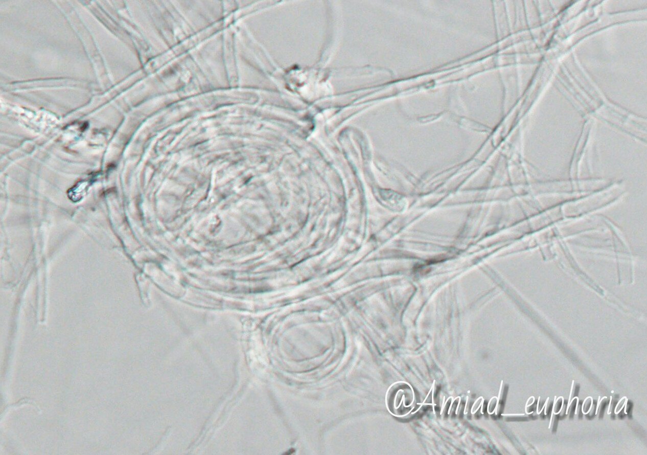 𝚂𝙾𝚁𝙰 님의 트위터 今日の菌類３ Mycelia Sterilia 時々見られるコイル状に巻いた菌糸は何を意味しているのだろう T Co Hnqdps8fe7 트위터