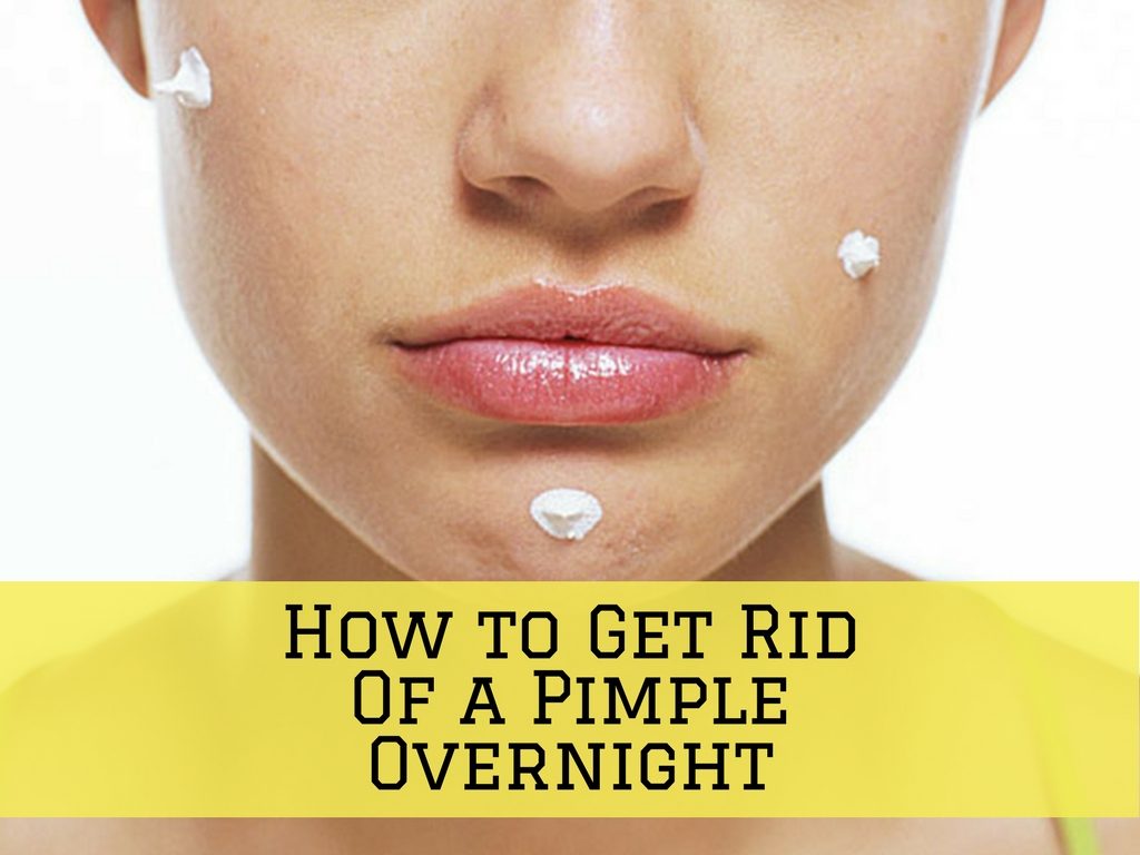 pimples and acne treatments Acne forms pimples, also known as zits or spots, and can be persistent and difficult to control there are however safe and effective treatments available. pimples and acne treatments Acne forms pimples, also known as zits or spots, and can be persistent and difficult to control there are however safe and effective treatments available.
