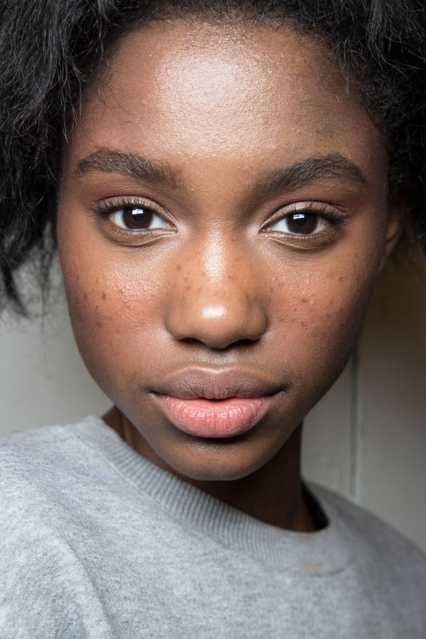 Sport ebony freckles natural