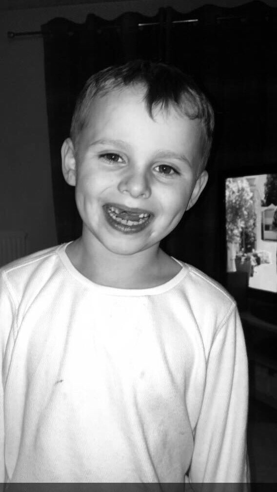 LeahThom097's tweet photo. When sibling play fighting goes wrong π #flyingteeth https://t.co/ZytIIlMvY8