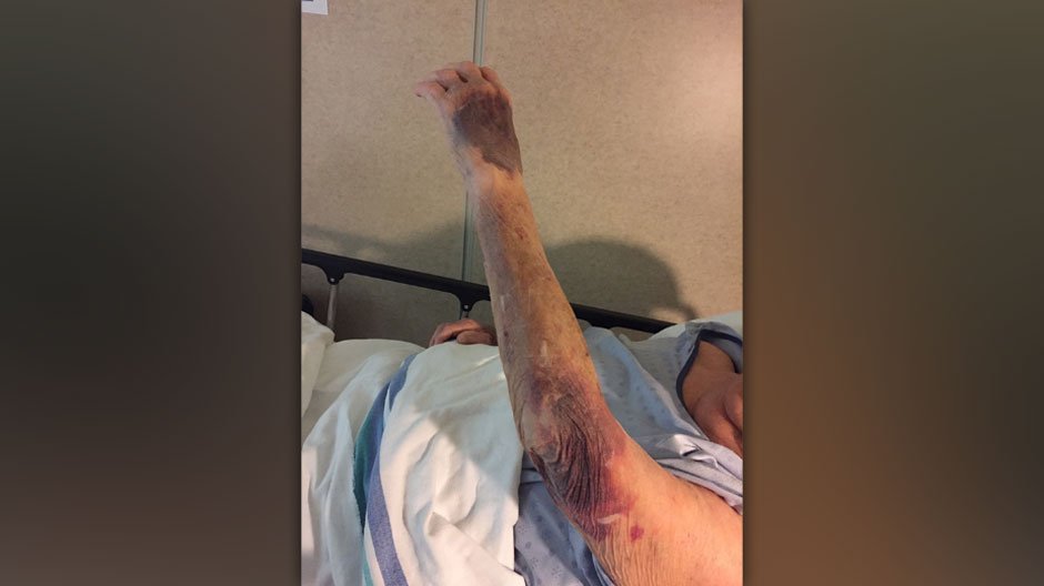 tvanouvelles's tweet photo. EXCLUSIF | Une dame de 78 ans laissée au sol plus de 3 heures avec une hanche fracturée, faute d’ambulance https://t.co/jaisSQDf2y https://t.co/NrODwzRTl4
