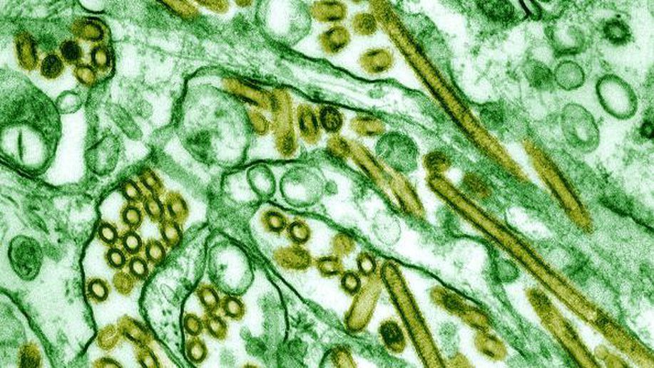 detikcom's tweet photo. Penampakan Virus Flu Burung Lewat Mikroskop https://t.co/5cPpGv22NG via @detikHealth https://t.co/RkIJyVPrXg