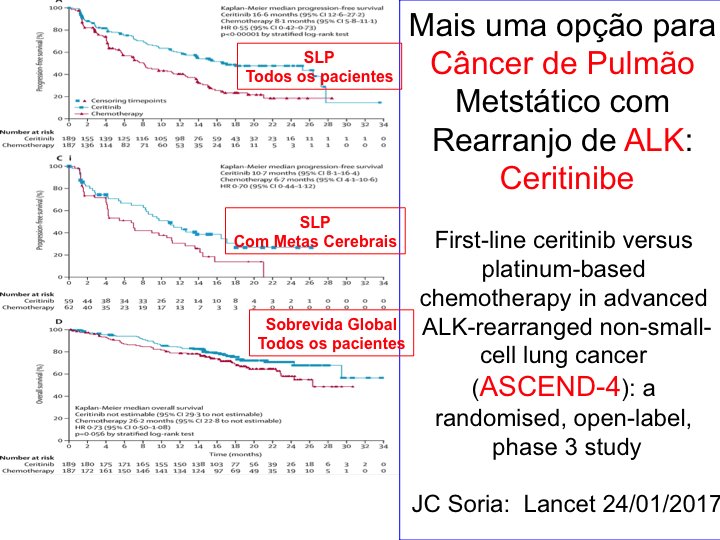 DrRiadYounes's tweet photo. Nova opção muito interessante para CÂNCER DE PULMÃO metastático, com rearranjo de ALK. Vale a pena ler mais este estudo de Soria no Lancet! https://t.co/rALqtMJa25