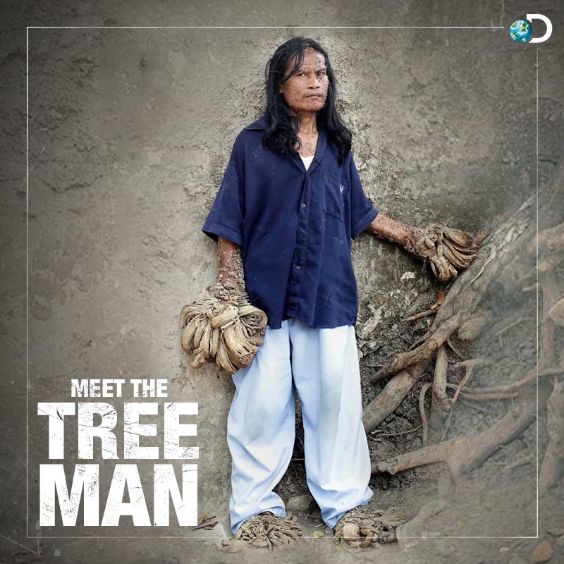 Treeman Meets Treeman