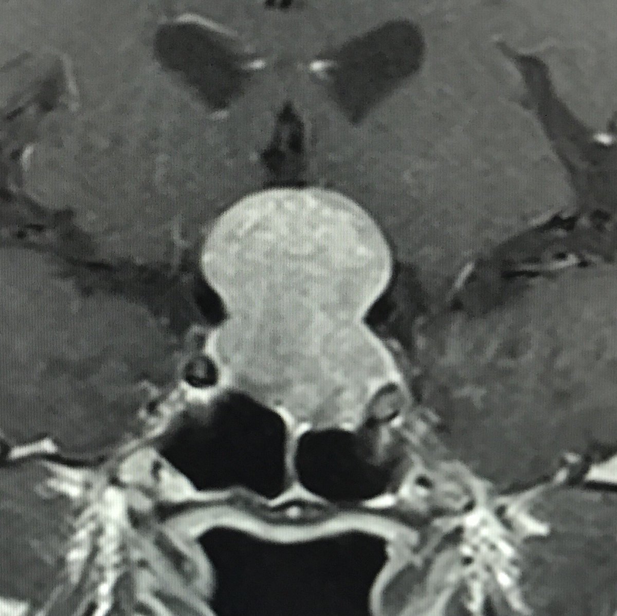 CaseSurfer's tweet photo. Good Monday for everybody!
What is this?
Share cases, experiences and knowledge in @CaseSurfer https://t.co/hevBSYRpuz