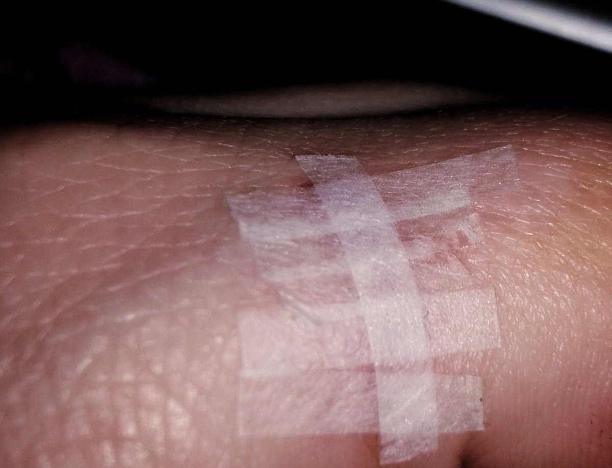 DaisyDazied's tweet photo. Ended #ShootDay by slicing my finger open on a broken prop 😕 #Ouch #FilmmakingInjury #GoodShootDayThough!
@piskieface

🎬 #VesselInTime 🎬 https://t.co/THCxSgeCLZ