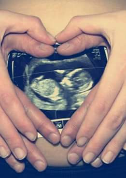 #DulceEspera💖 #3Months #MiAngel👶❤ <a href="/GerardoOtero19/">Gerardo Otero</a> Gracias por acompañarme amor mio❤💋.