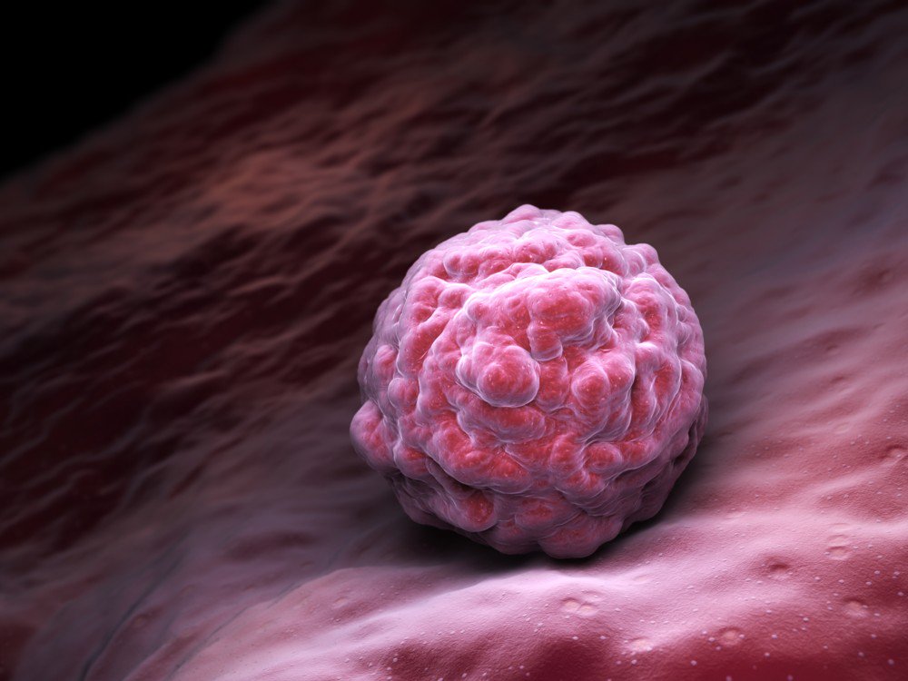 muyinteresante's tweet photo. Logran detener la progresión de la esclerosis múltiple durante al menos 5 años.¡Fantástico! Te lo contamos:
https://t.co/m4Xrpst2TD #Ciencia https://t.co/TikdXcB53z