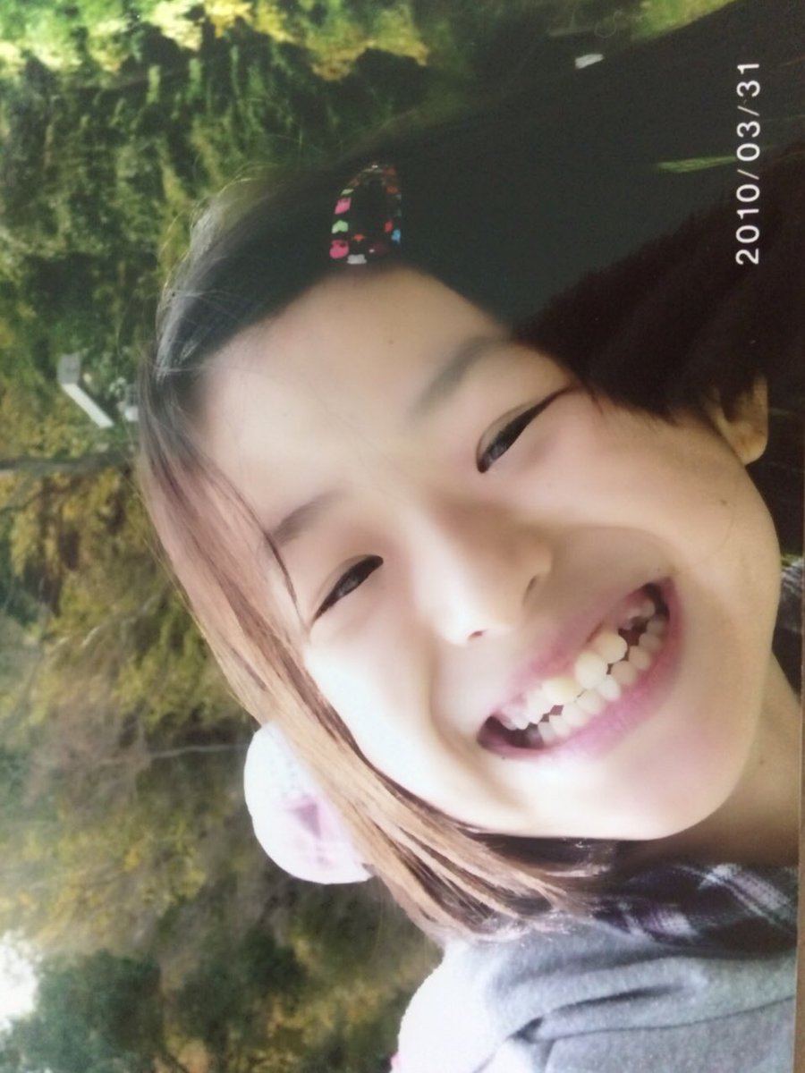 はぁちゃん Seven Colors No Twitter はぁちゃんです ニキビが出来たので家では前髪をピンで止めてます こんなに 前髪とめるの小学校以来 笑 歯が抜けてるはぁちゃんです笑 小学校4年生かな ゆいちゃんぐらいのボブ 細かったけど