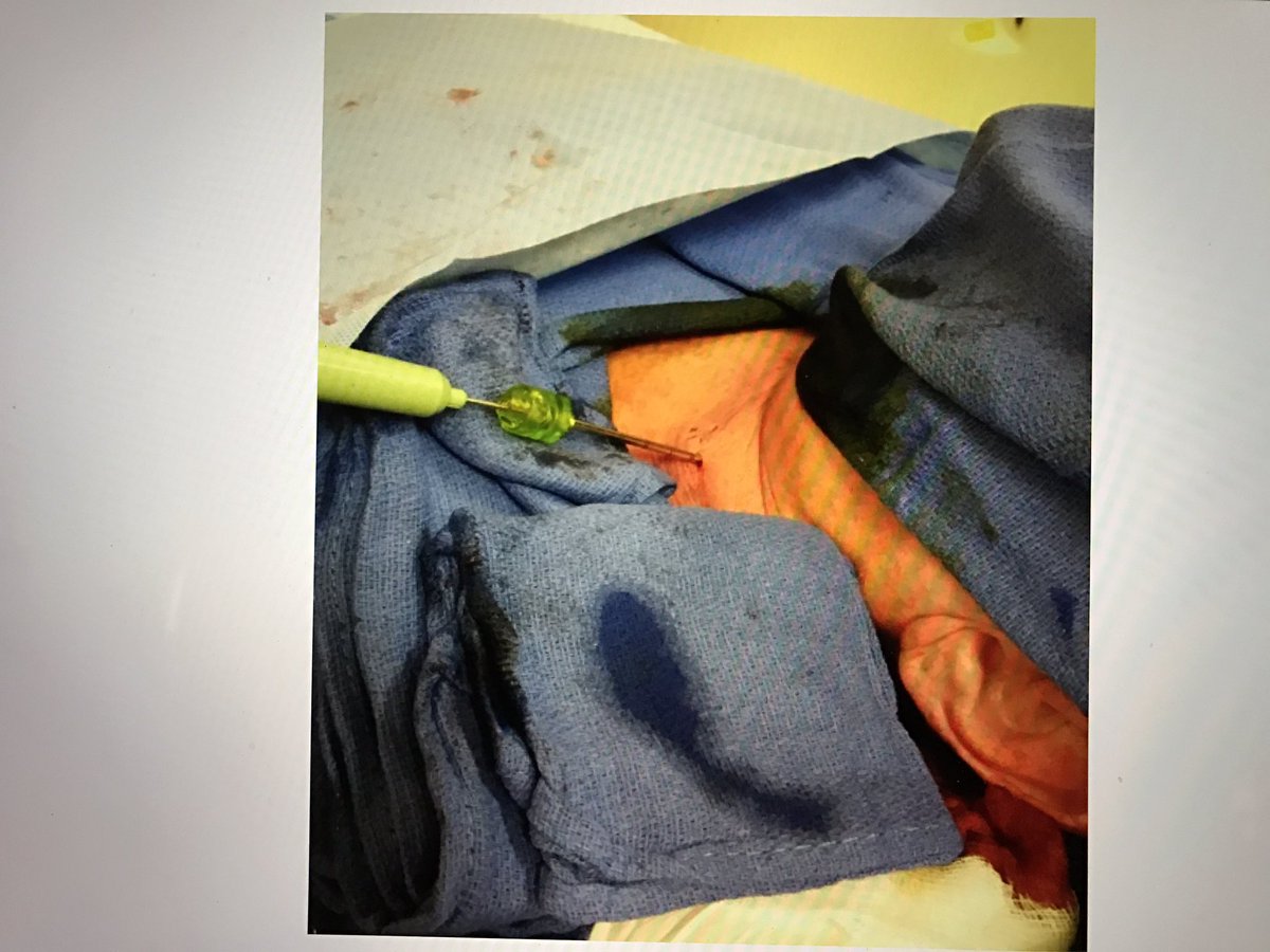 Roger Williams_IR tweet media