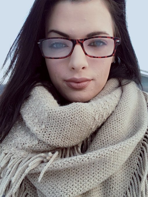 Good Morning xo hope you all have a great day❤ https://t.co/KMsJVJWzYg<a href="/tag/cysticacnesucks"class="tags"><span>#cysticacnesucks</span></a>