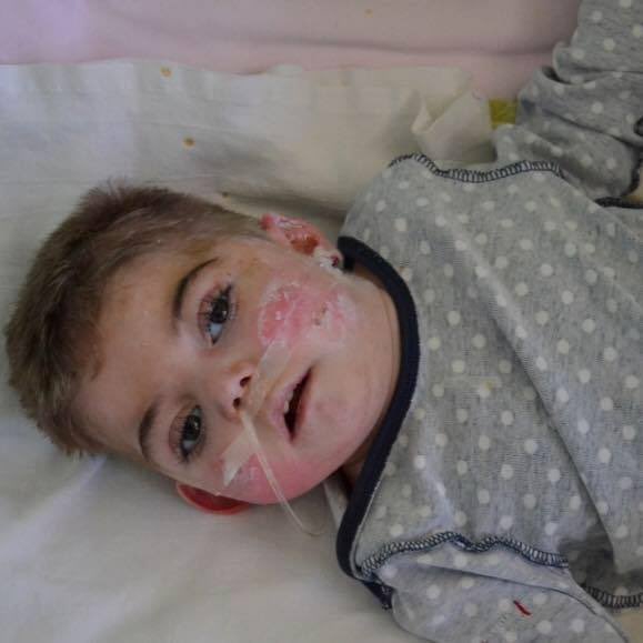 EbPromise's tweet photo. Travis is an EB orphan in dire medical condition. Keep him in your thoughts &amp; prayers and #RTforTravis #eborphan #eb {follow for updates} https://t.co/Zv37424B62