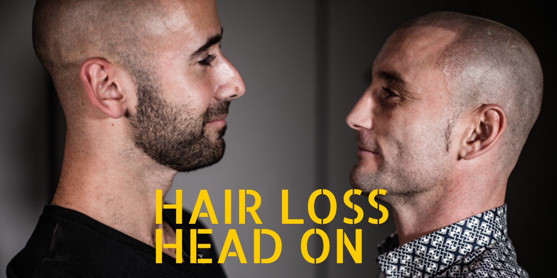 Scalp Micro Usa On Twitter Fight Hair Loss Head On