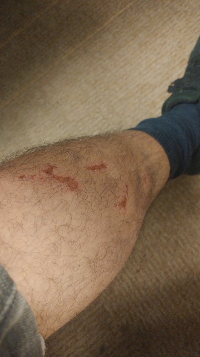 JuanFigueroa51's tweet image. I would say I'm still Questionable for Sunday's game after getting stepped on last week...but nah I'm a full GO for my team #QB #ForMyTeam