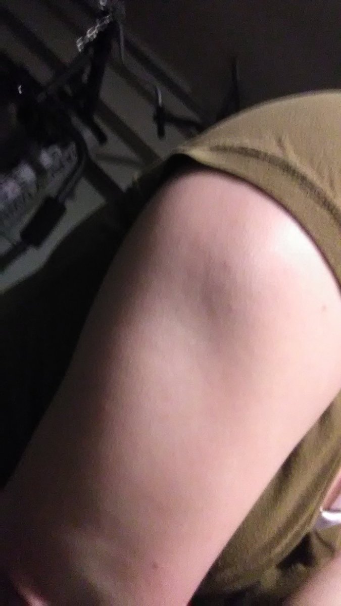 MyRadioClash's tweet photo. Right tricep. #TheBeastWithinMe https://t.co/pzjf7lPgqR