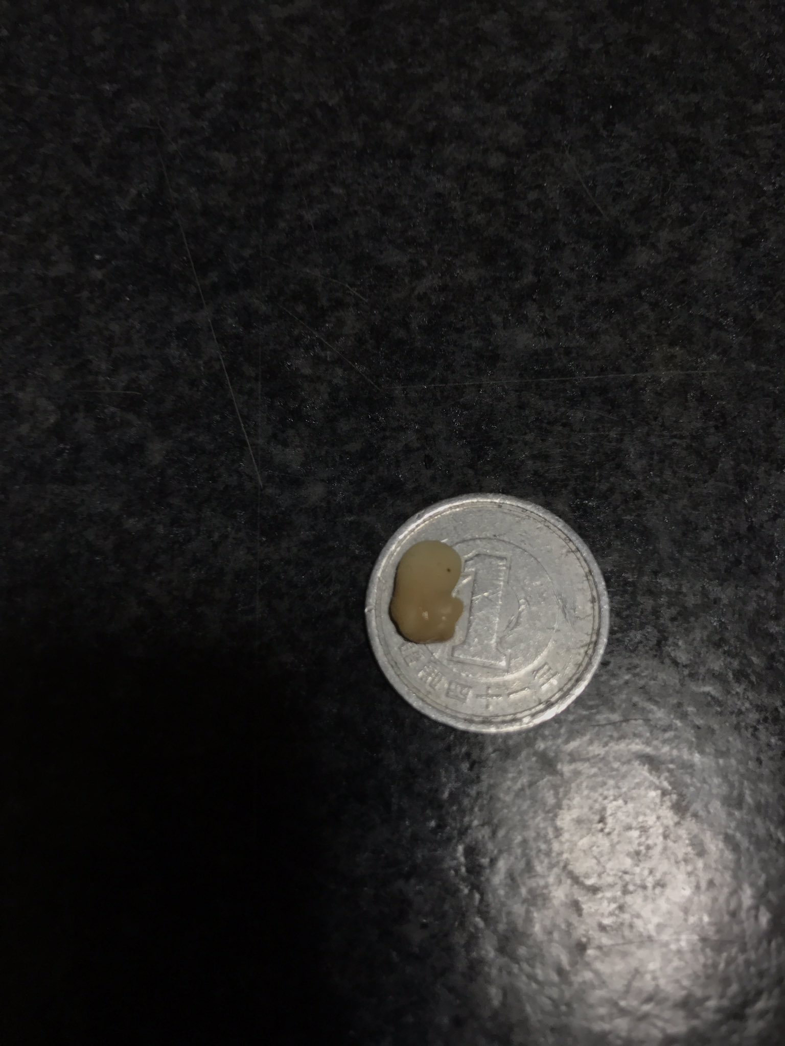 黒猫 クロネ でかい膿栓が出てきた 膿栓 臭いやつ 臭い玉