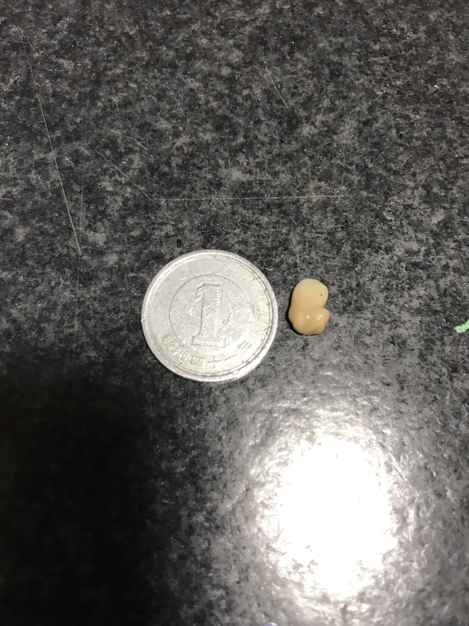黒猫 クロネ でかい膿栓が出てきた 膿栓 臭いやつ 臭い玉 T Co Qik7lfjkra Twitter