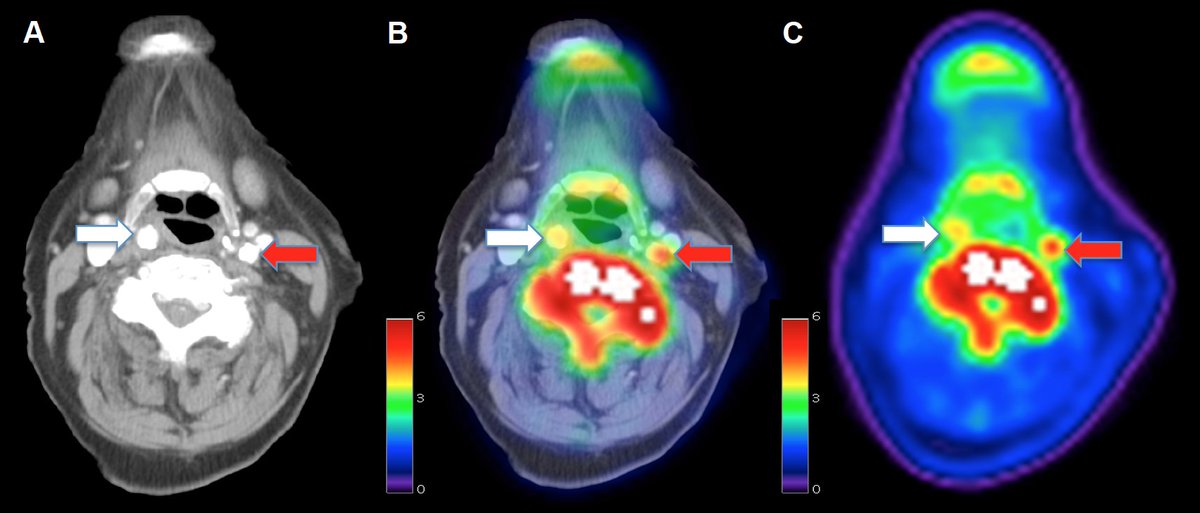 nr_evans's tweet image. What is going on here? I&apos;ll be presenting our PET work at 5.30pm, MP 29. Why not come and find out more? #ISC2017 @DunhillMedical @CamStroke