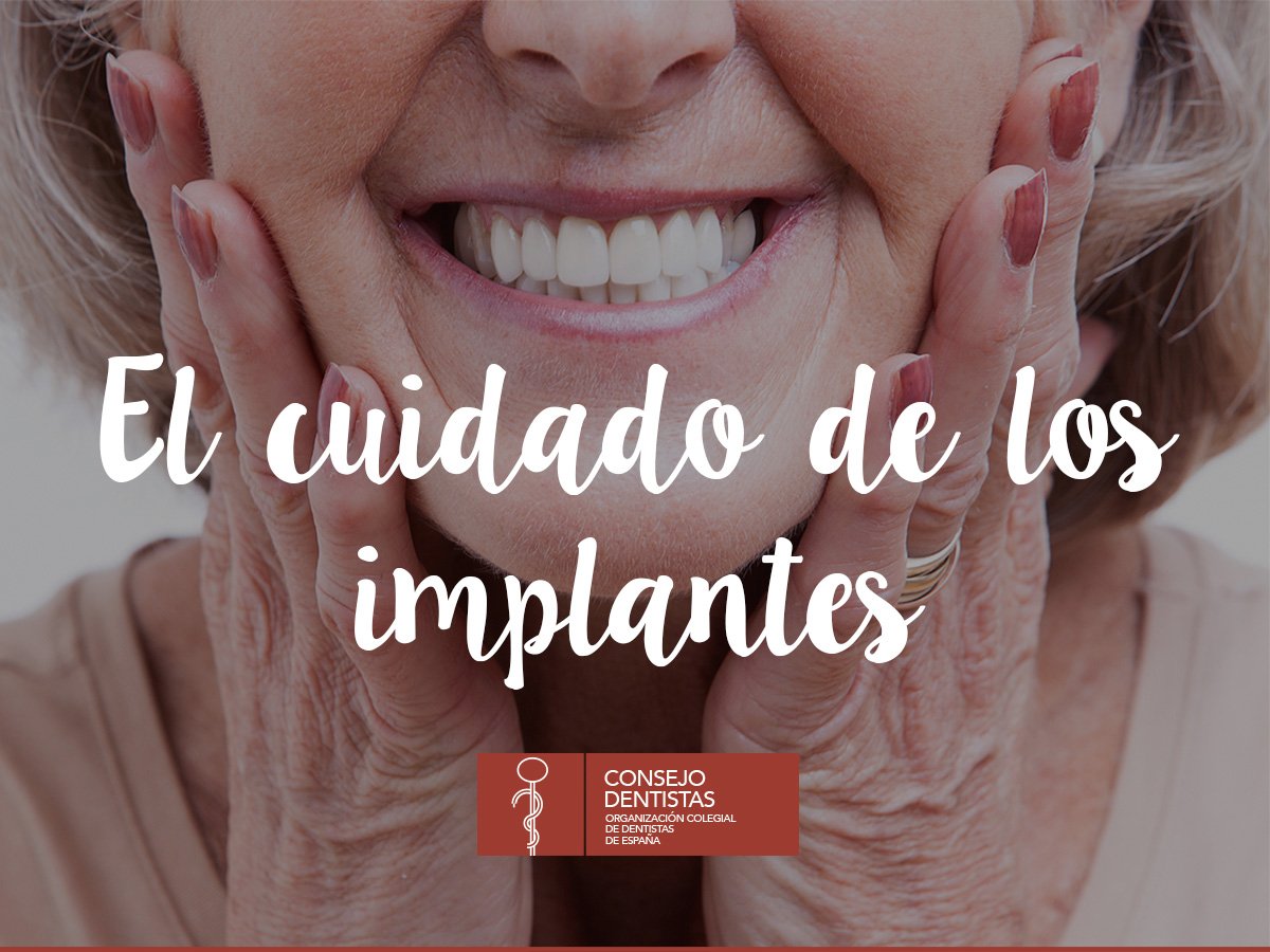 CNSJ_Dentistas's tweet photo. Los #implantes dentales deben ser cuidados por el paciente como si fueran una pieza "natural" más, ayudando a prevenir la periimplantitis. https://t.co/UzWvr1Ucon