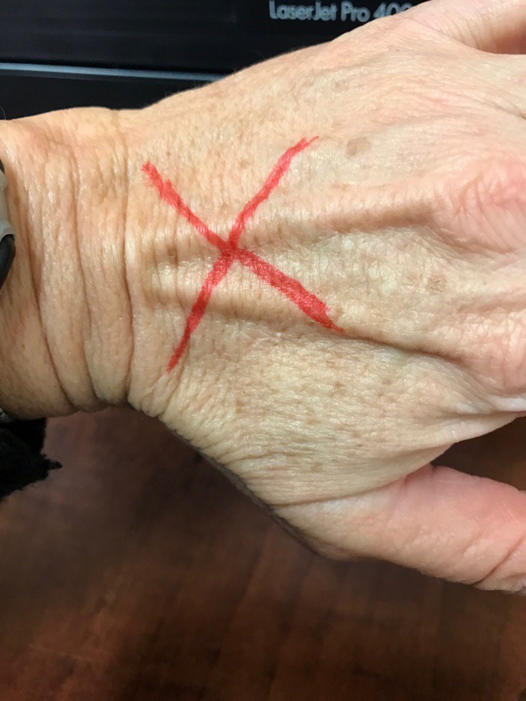 RinO2o's tweet image. #EndItMovement