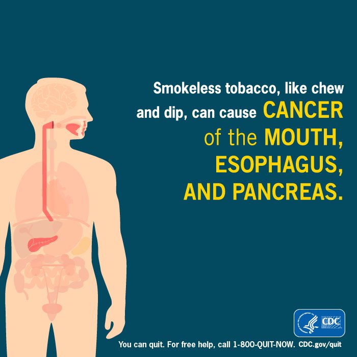 TobaccoFreeDJW's tweet photo. Smokeless ≠ Harmless
#GASpO17 #GreatAmericanSpitOut #quittobacco #quitdip #ucanquit2 https://t.co/vSMnXs4uEl