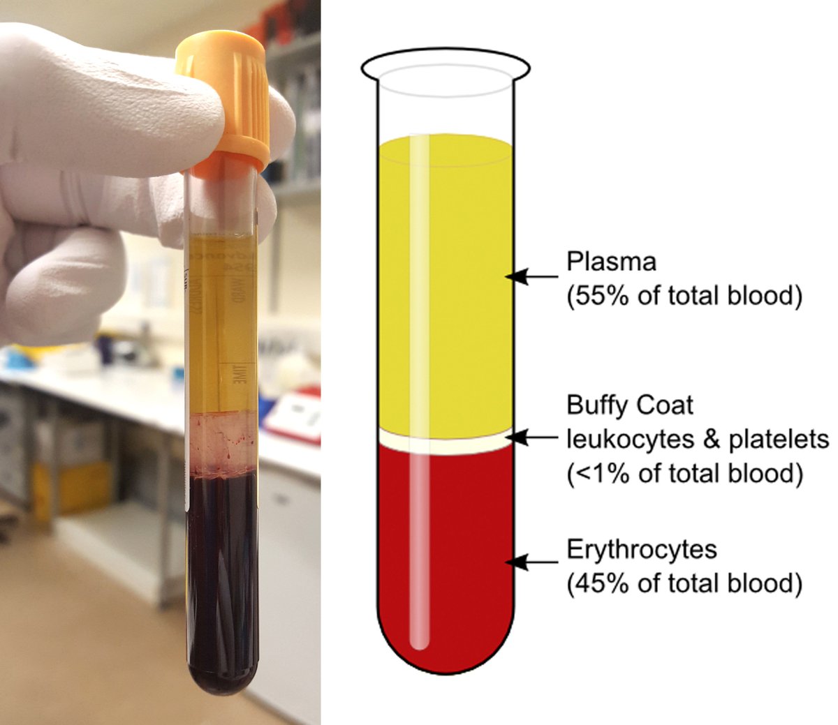 Кровь без плазмы. Сыворотка крови в пробирке. Плазма крови в пробирке. Сыворотка крови и плазма крови. Buffy Coat.