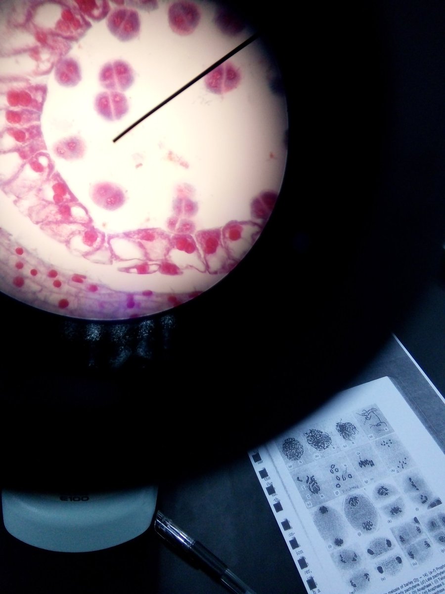 FatinAt78691211's tweet image. From my lens..searching for each phase of meiosis of lily flowers. plus shaky hands to snap pic from the microscope.😷 #geneticlab #tetrad