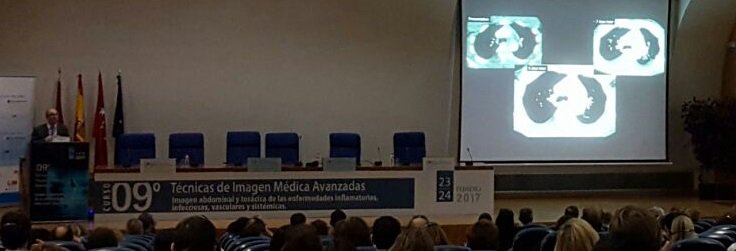 HTmedica's tweet photo. Sobre manifestaciones torácicas de los síndromes hereditarios por Dr. Fernando Gutiérrez continuamos con imagen médica avanzada en #IMA9 https://t.co/6BEt74nqF1
