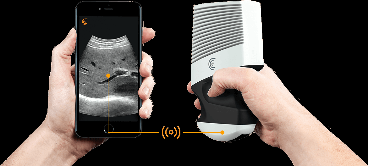 bruckenkopf's tweet image. Clarius handheld wireless #UltrasoundScanner CE approvedbrueckenkopfgmbh.com/forums/topic/c…