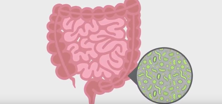 Moeschamara's tweet photo. IBD Gut Microbiomes are Quite Volatile Compared to Healthy Ones https://t.co/3fxE9DBbld #immunology https://t.co/UZYrQWcchm