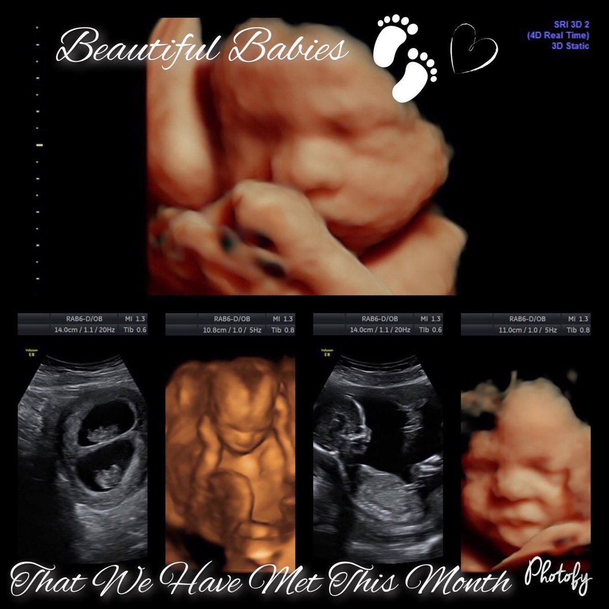 GlimpsePrecious's tweet photo. 👶We would like to say a huge thank you to all the Families that we have met so far and letting Precious Glimpse be apart of your Journey! 👶 https://t.co/BsWm3dD7Lp
