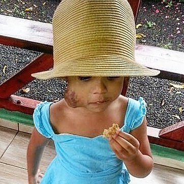 condesatv1's tweet photo. Gracias a otra alma solidaria ya tenemos 60,000 pesos para la cirugía de #Chanick 😍😍 Ahora solo nos faltan RD $ 303,000 😍😍😍 https://t.co/BbPRqRMDaF