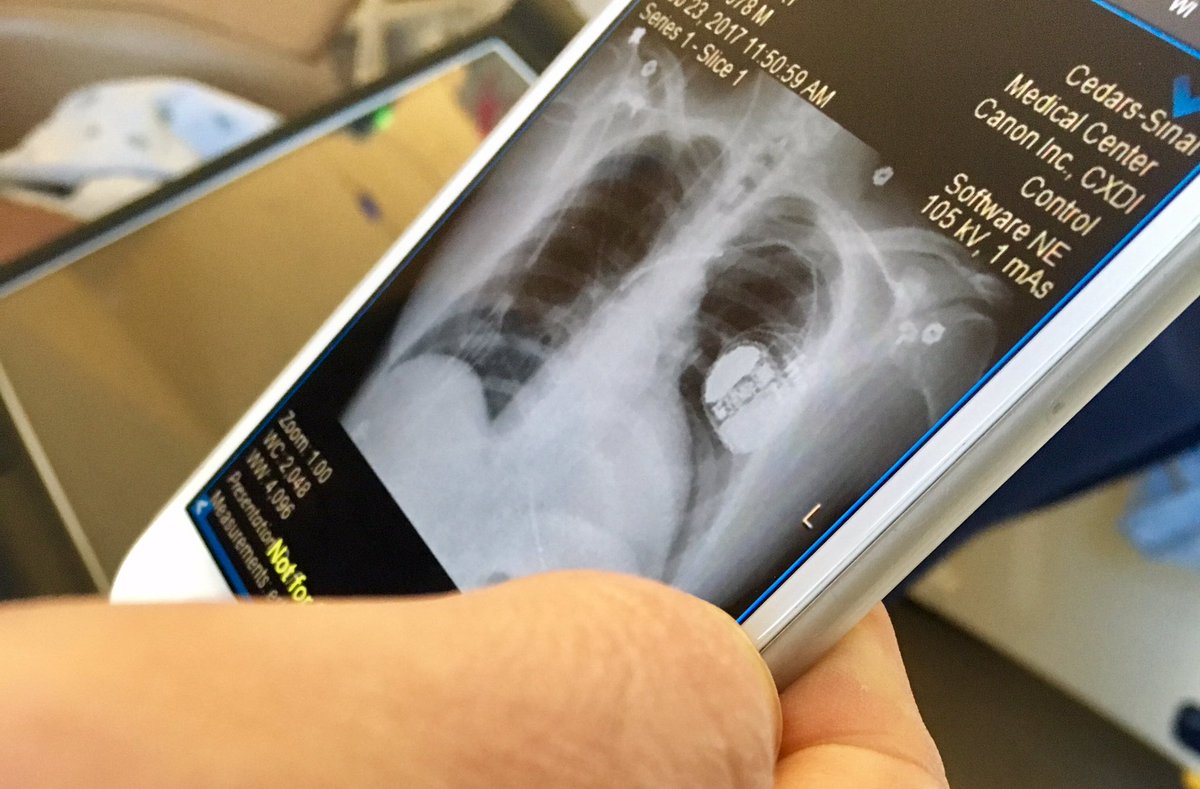chrissyfarr's tweet photo. Docs can view medical images from an iPhone 7 Plus, a benefit of a larger screen. Getting a tech tour @CedarsSinai https://t.co/PmtrADEYxy